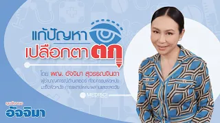 การฉีดโบทูลินั่มท็อกซินช่วยในการรักษาเปลือกตาตกได้อย่างไร