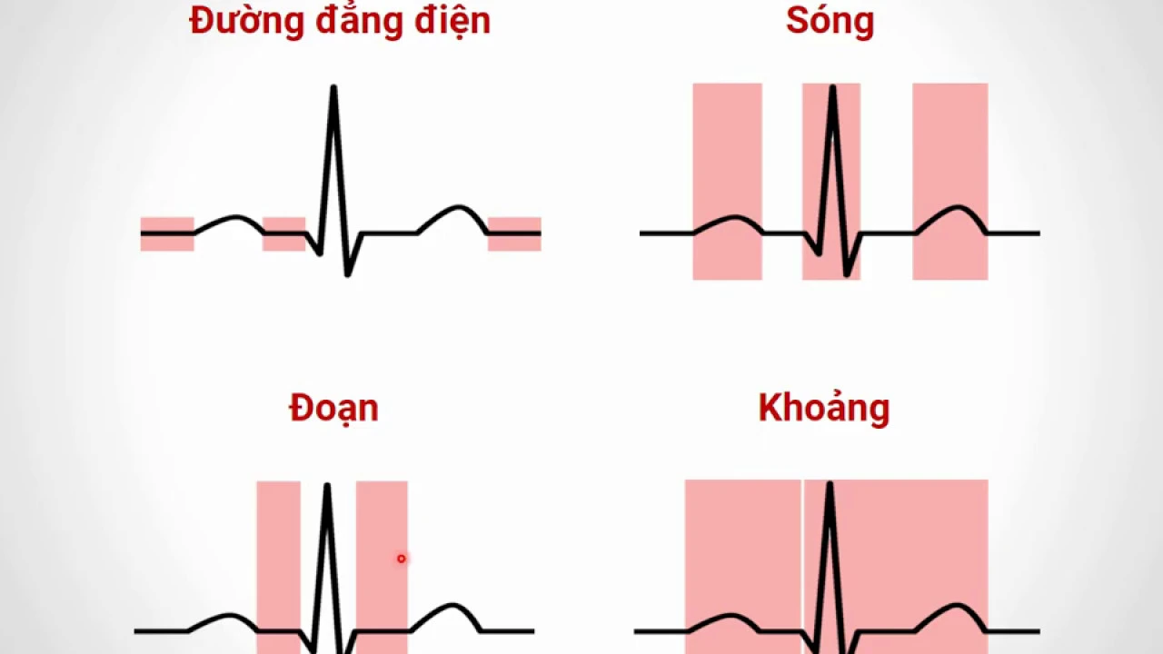 ĐIỆN TÂM ĐỒ (Phần 1)