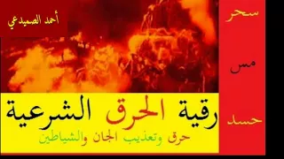 رقية الحرق سي د احمد الصميدعي 