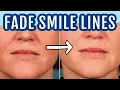 12 ways to fade smile lines nasolabial folds Dr Dray