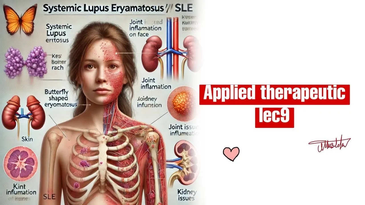 Applied therapeutics lec9 final part | SLE | صيدلة م5ك١