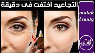 التجاعيد اختفت والنتائج لا تصدق🔥دهنه منه ولن ترى تجاعيد مدى الحياة‼️ريتينول الفقراء