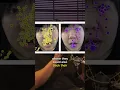 Download Lagu Dokter legt uit hoe autistische hersenen anders zijn opgebouwd!