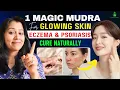 One Mudra for all Skin problems Cure Eczema Psoriasis Dryness Allergies