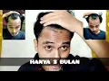 Download Lagu CARA MENUMBUHKAN RAMBUT BOTAK SAMPING atau BOTAK M atau BOTAK BEJITA hanya dalam 3 Bulan