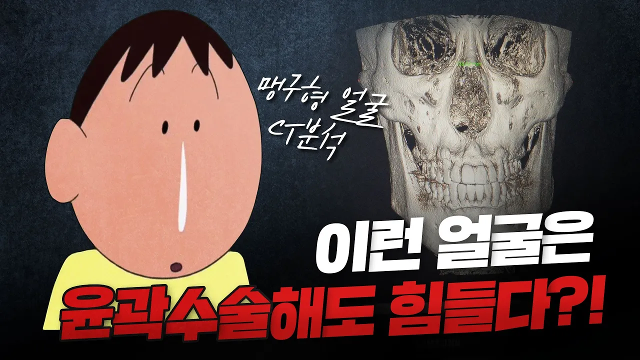 CT분석 절망편...  얼굴 긴 사람 필수 시청!