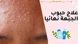 حل نهائي لحبوب الجبهة الفطرية وحبوب تحت الجلد بارخص الاسعار 