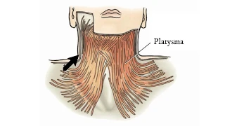 Platysma Muscle - Massage Anatomy
