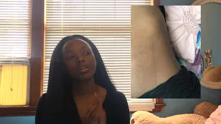 how i got my scar storytime