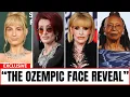 15 Shocking Ozempic Celebrity Transformations You Can t Unsee Then and Now 2026
