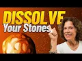 Don t skip this if you want to dissolve your kidney stones