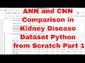 Kidney Disease Classification ANN and CNN from Scratch Python Code ANN and CNN Python Code Part 1
