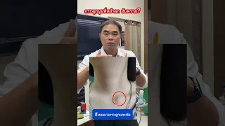  ทำไมกระดูกไหปลาร้าข้างหนึ่งถึงอาจนูนขึ้นมาได้ 