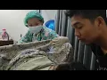 Download Lagu Perjuangan Melahirkan Ny.C Mengejan Hingga 2jam Lebih\u0026Detak Jantung Bayi Melemah #persalinannormal