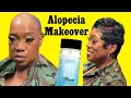 Rate this Salon 1-10 Alopecia Makeover