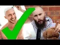 Johannes Bartl Talks About Being Bald