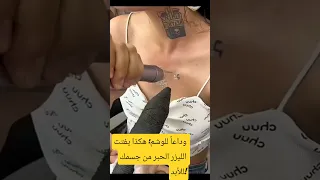 كيف يتخلص جسمك من الوشم 