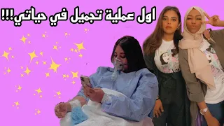 سويت اول عملية تجميل في حياتي النتيييييجة وااااااو 