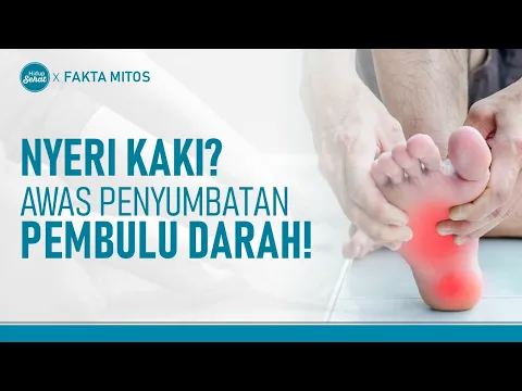 Kenali Gejala Penyumbatan Pembuluh Darah di Kaki