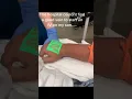 Vein Finder Devices
