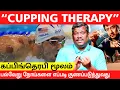 Download Lagu CUPPING THERAPY | USES \u0026 BENEFITS | LEARNING | EDUCATION | HEALER BASKAR | TAMIL