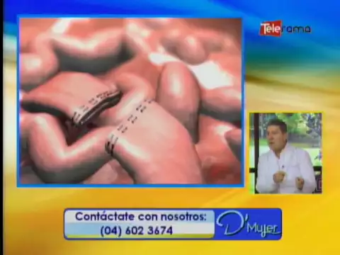 Cirugía bariátrica para controlar la diabetes