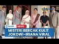 Download Lagu Misteri Bercak Kulit Jokowi-Iriana Viral, Dokter Tifa Nyeleneh: Mungkin Lensa Kameranya Kotor