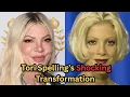 Tori Spelling Before After The Truth Behind Plastic Surgery Rumors