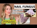 Dermatologist Shares Treatments for Nail Fungus Prevention Tips Dr Sam Ellis