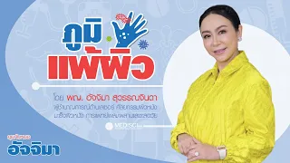 ทำไมการดูแลลำไส้จึงสำคัญต่อการควบคุมภูมิแพ้ผิวหนัง