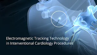 Electromagnetic Tracking Technology in Interventional Cardiology Procedures
