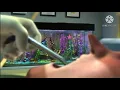 Finding Nemo - Dentist Scene