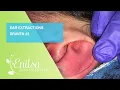 Ear Extractions on Draven