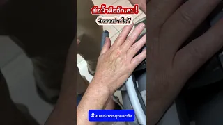 สาเหตุของอาการปวดและบวมที่ข้อนิ้วมือคืออะไร