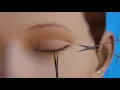 Lagu Surgery to Remove Lesions from the Eyelid