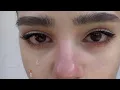 levantar parpados caidos