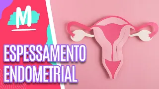 Conheça mitos e verdades sobre ESPESSAMENTO ENDOMETRIAL - Mulheres (06/12/22)