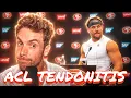 49ers DE Nick Bosa Dealing With ACL Tendinitis