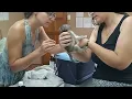 Baby monkeys are separated from their foster moms receive urgent treatment for mango worm