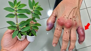  apenas 1 folhas limpa seu corpo!!!