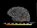 Demonstration of MNE-Pythons new vector source estimates