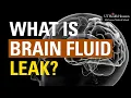 What is Brain Fluid Leak Symptoms and Treatment for CSF Leak