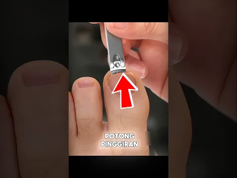 Stop Potong Kuku Kaki Kayak Gini, Bahaya! 😱🦶 #shortvideo
