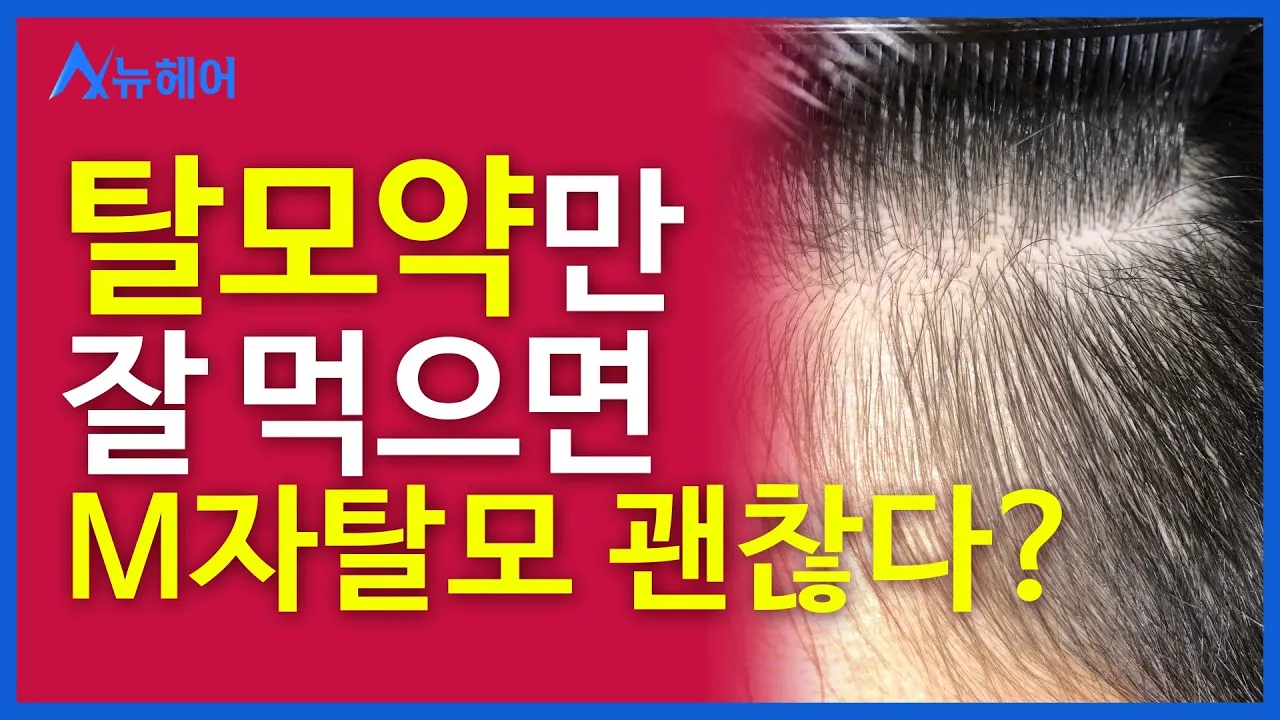 할아버지가 탈모인데 엠자 탈모가 걱정이에요  l 우리끼리 탈밍아웃 l 뉴헤어