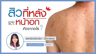 สิวที่หน้าอกหรือหลังเกิดจากสาเหตุอะไรบ้าง และมีปัจจัยใดที่ทำให้สิวแย่ลงได้
