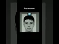 Download Lagu How Hormones affect your Face #health #face #testosterone #estrogen #hormones