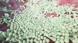 Vaginal Yeast Infections 