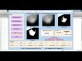 Matlab Code for BREAST CANCER DETECTION Using Machine Learning Image Processing Project