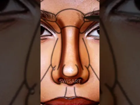 Tyla perfect face surgery! #tyla