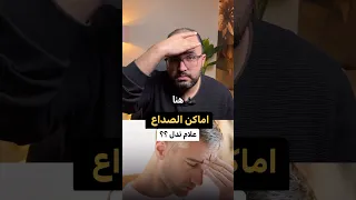                                                                            دندنها
